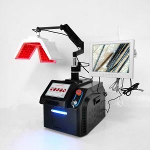 Красная обработка роста волос лазера диода машины 650nm терапией света СИД PDT