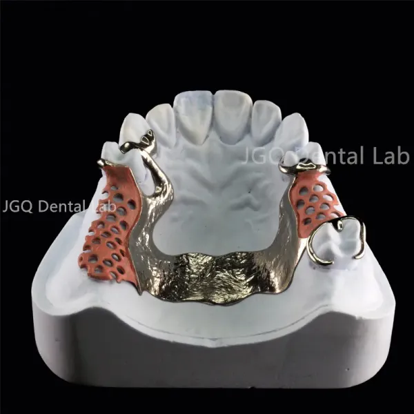 Dental Lab Durability Implants Make Cost-Effective Option in The Long Run