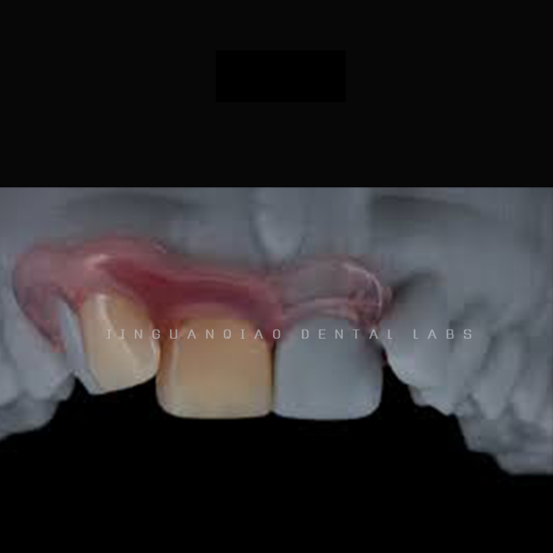 Valplast Flexible Denture Invisible Base Similar Natural Gum Color Persistent Color Change