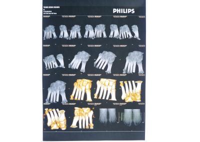 32cm * 43cm Xray Paper Medical Laser Imaging Film For KND-DRYTEC-4000 KND-K