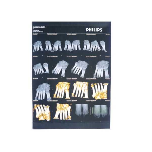 película médica de la proyección de imagen del laser del papel de la radiografía de los 32cm * de los 43cm para KND-DRYTEC-4000 KND-K