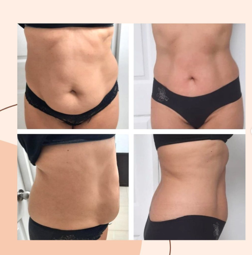 2023 6 en 1 Máquina de belleza de salón de belleza de pérdida de grasa del vientre