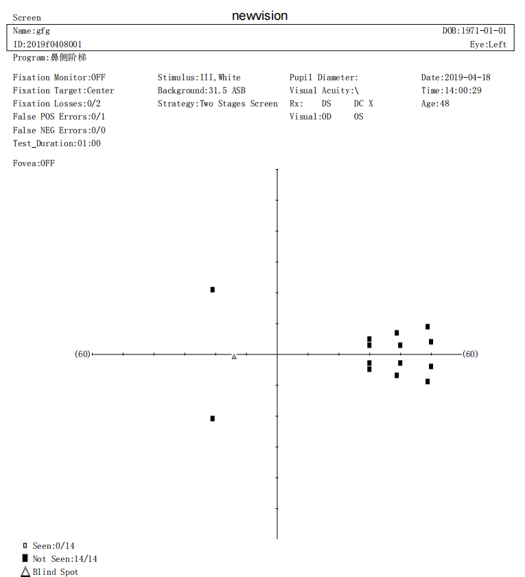 Ophthalmology Projection Perimeter Visual Field Analyzer Automatic Computer Perimeter Touch Screen MSLBIO01