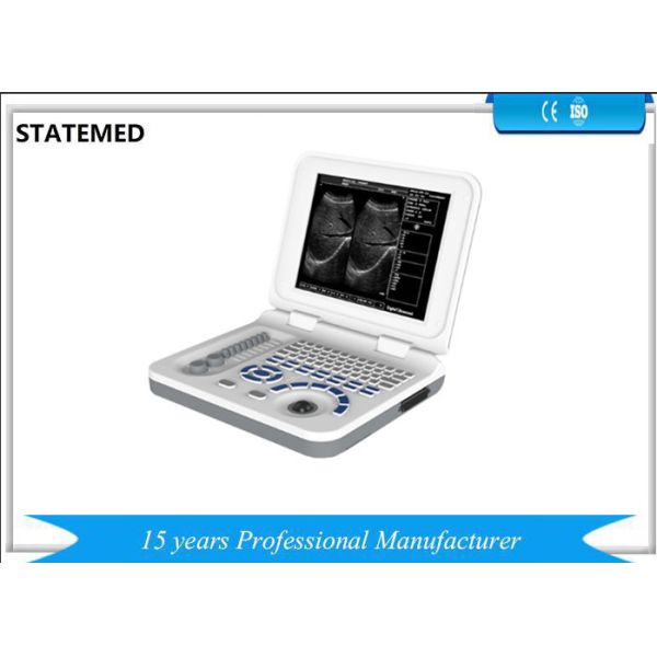 Hospital Equipment Portable Ultrasound Machine With 10.4 Inch LED Displayer