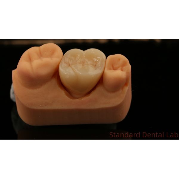 Mill and Centring Full Zirconia Crown , China Dental Lab Fast Delivery