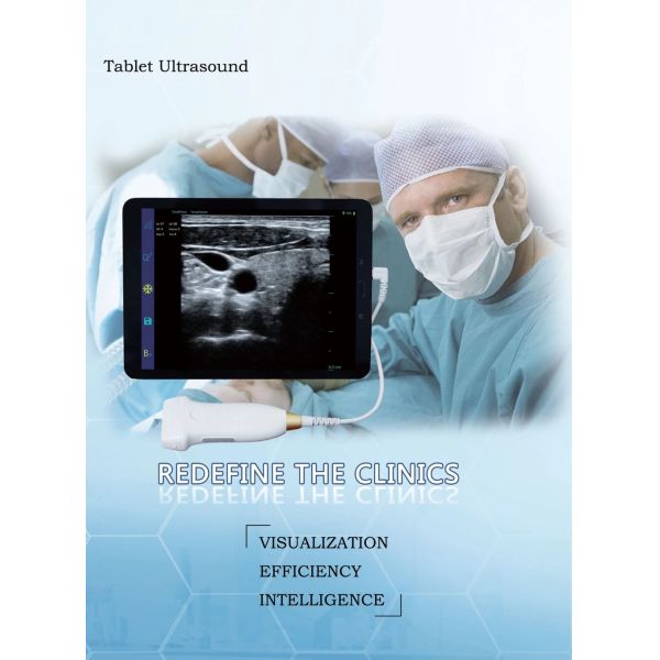 Hot Sale Smart USB Convex Medical Doppler Ultrasound Scanner Ultrasound Probe