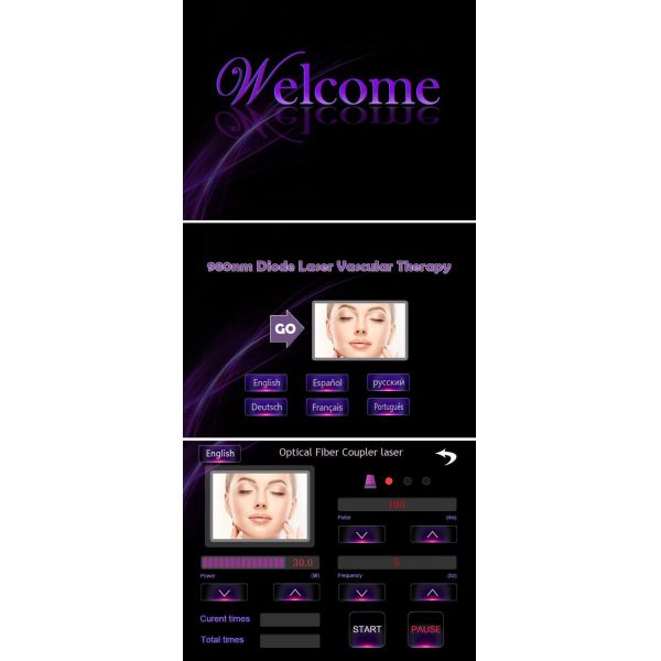 Высокочастотная машина 5Hz удаления вен паука сбрасывает CE красноты