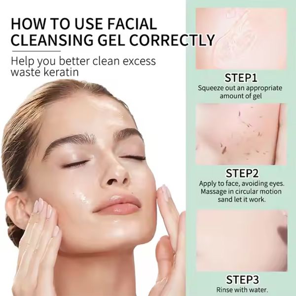 Gel limpiador facial exfoliante herbal OEM para adultos, removedor de piel muerta exfoliante