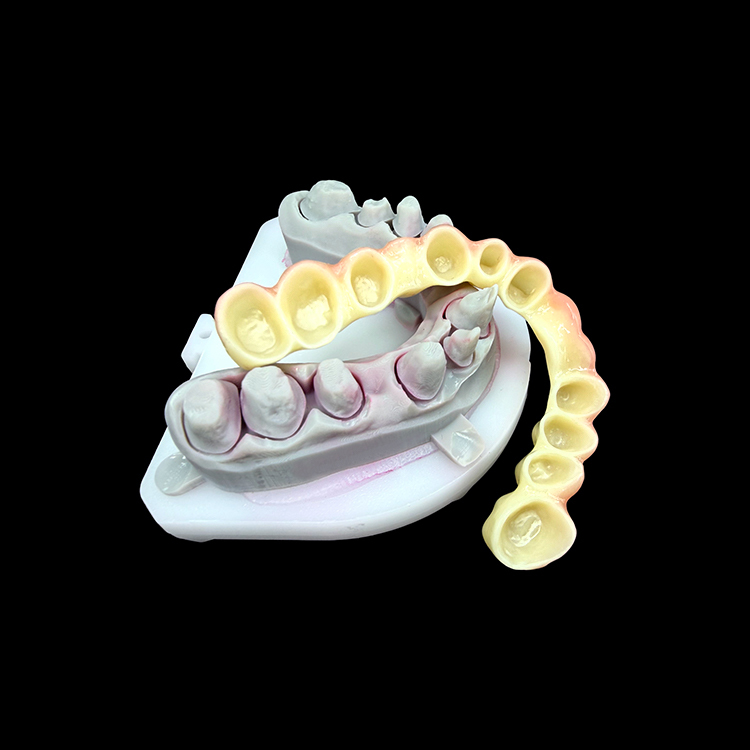 Zirconia Porcelain Dental Crown CAD/CAM Precision Natural-Looking Aesthetic Finish ISO13485 Certified