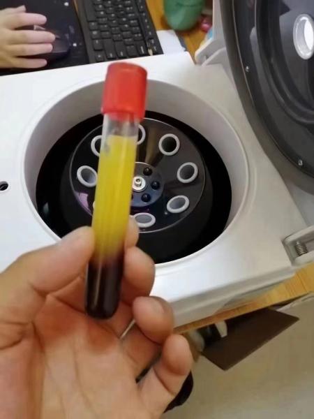 TD4D 5ml 10ml 15ml 20ml Centrífuga PRP de baixa velocidade 4000 rpm