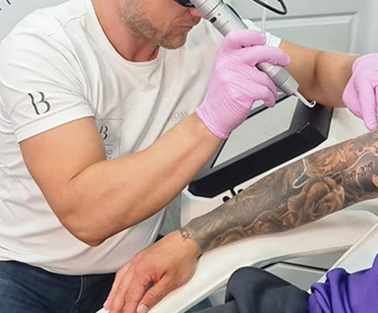 Tattoo Removal Picosecond Laser System Pigmentation Skin Rejuvenation 1064nm 532nm