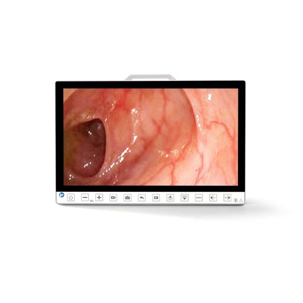 Portable 13.3 Inch 1080P Endoscopy Camera System With Recorder for Laparoscopy ENT Surgery