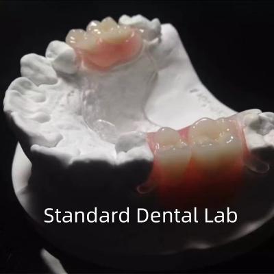 Estrutura de metal fundido transparente flexível Dentes parciais Alta estética Perfeito ajuste
