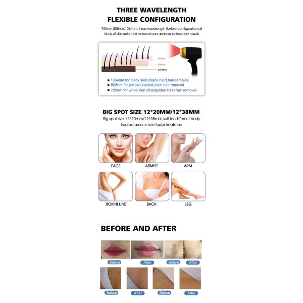 Medical Aesthetics Titanium Ice Laser Soprano Hair Removal Machine With Advanced Cooling System