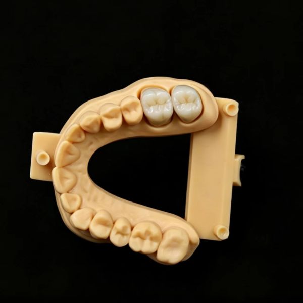 Innovative Dental Zirconia Material Offering High Translucency and Exceptional