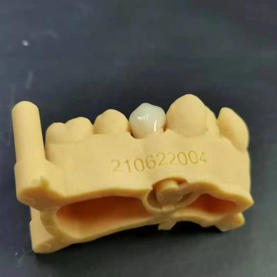 digital design + model printing +zirconia crown