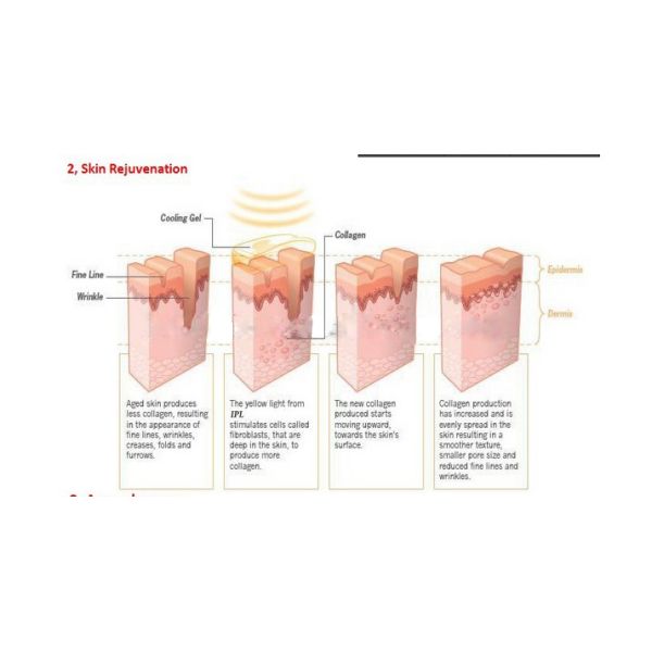 Laser for tattoo Removal Body Slimming Ipl Beauty Machine For Hair Removal