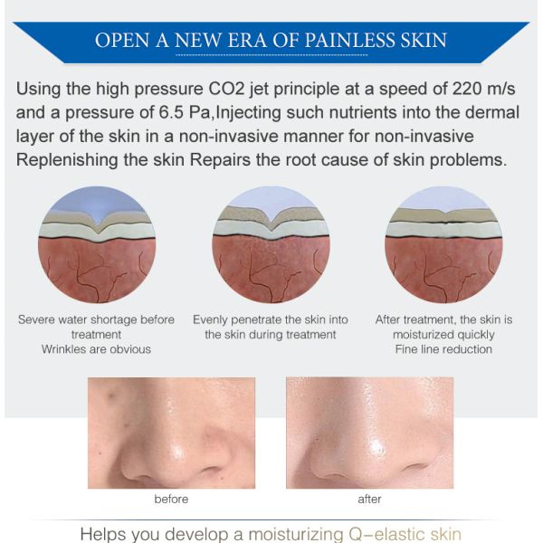 Magic Skin Rejuvenation Device Multi-Functional Face Exfoliating Lifting Tightening Home Beauty Instrument