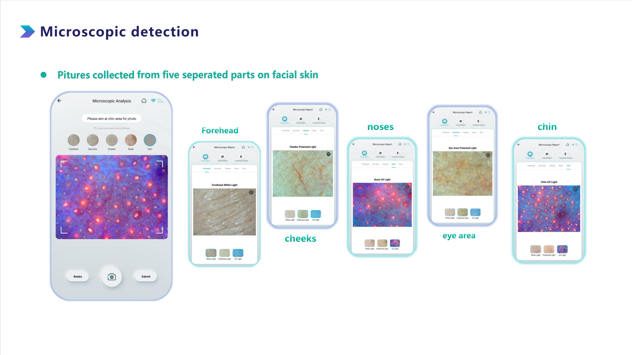 Comparion Price Skin Analyzer Facial Skin Analysis for Sensitivity Problem