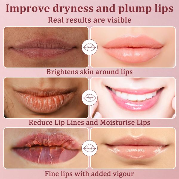 Crystal Cream Hydrating Collagen Lip Mask Intensive Repair For Deep Moisturizing