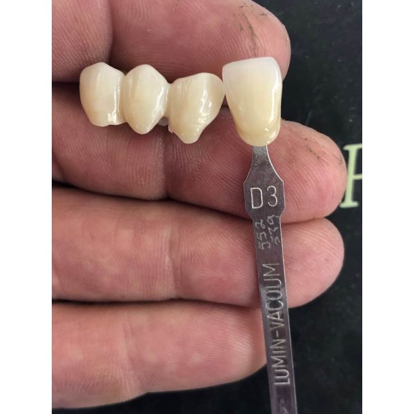 1200HV 3D Plus Dental Zirconia Block False Dental Zirconia Discs