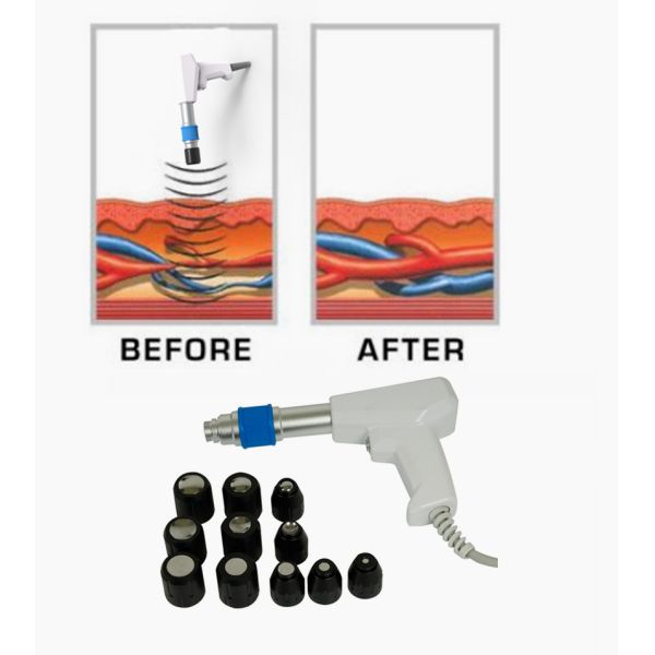 Машина LISWT терапией ударной волны низкой интенсивности для обработки ED