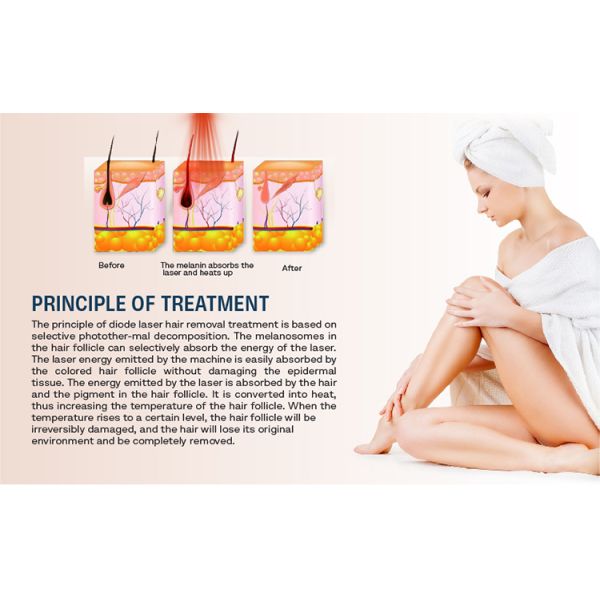 Oem 1800w 4 Wavelength 755 808 1064 Laser Hair Removal Machine Permanent Hair Remover Diode Laser Epilator