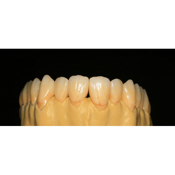 Porcelain Cubic Zirconia Teeth