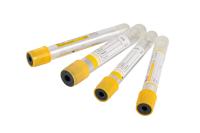5ml 6ml 7ml 8ml Gel And Clot Activator Yellow Serum Separator Clot Activator Tube