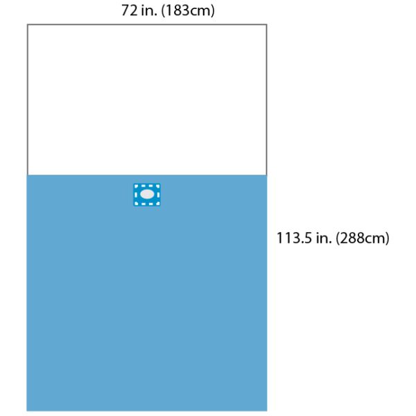 SP SMS SMMS SMMMS Neonatal Pediatric Sterile Disposable Drapes 40g 60g