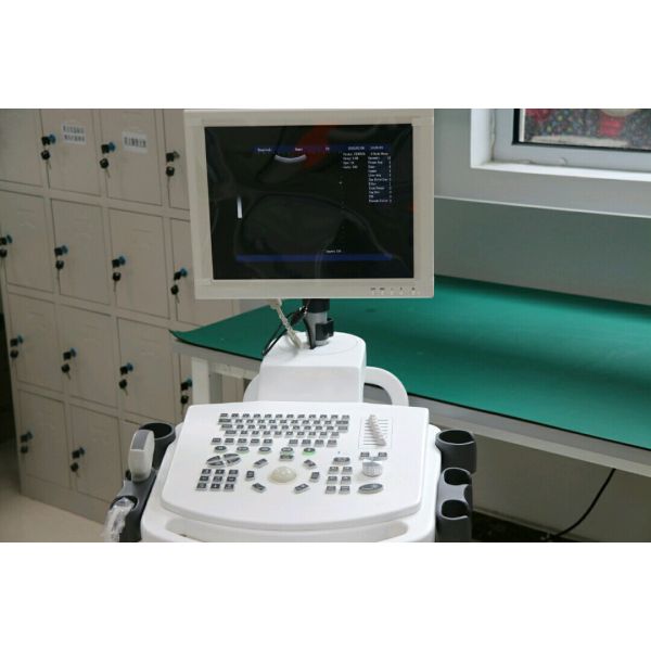 Trolley Ultrasound Machine Echo Price