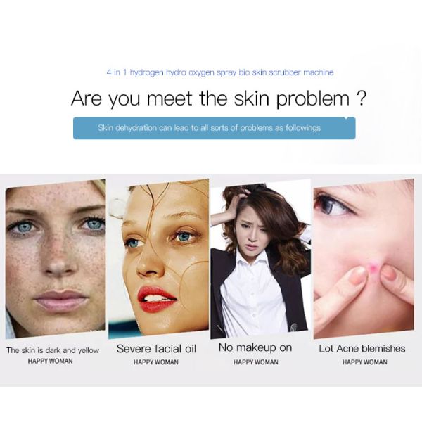 Мини многофункциональная косметическая машина для гидры Ультразвуковое удаление прыщей