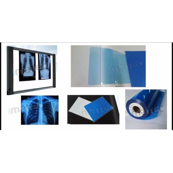 IMATEC Blue PET Inkjet Medical CR рентгеновская рентгенографическая пленка для принтеров Canon