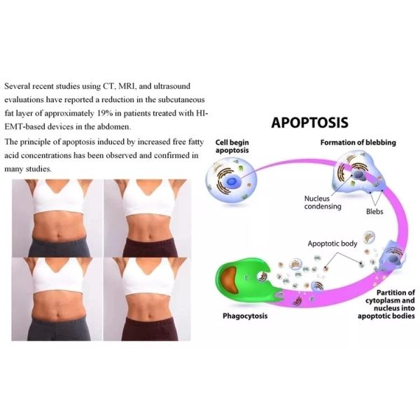 машина тела EMS высокой интенсивности 3000W ваяя для бедренных костей оружий взваливает на плечи