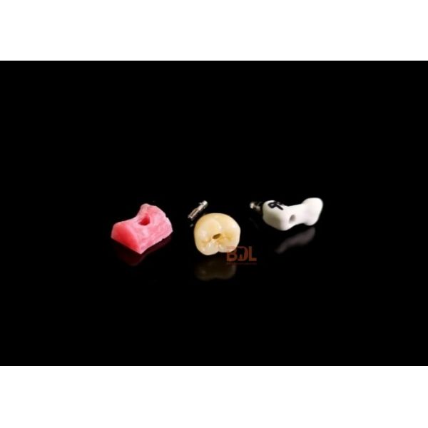 Digital Dental Implant Bar with Customized Scan Body All Ceramic Crown and Wax Pattern for Full Process Implant Restoration Control