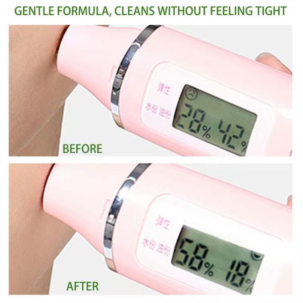 Al por mayor 100g Árbol de té Purificador de poros Cabeza negra Limpieza profunda Bálsamo Acné y manchas Eliminatorio facial Crema de maquillaje