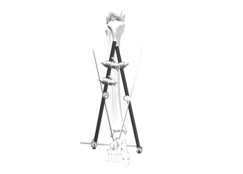 Ankle Joint External Fixation System Customized Design OEM / ODM Service