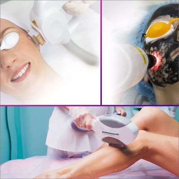 3 In 1 Laser Ipl Machine Multifunction Rf Tattoo Removal Hair Loss Beauty