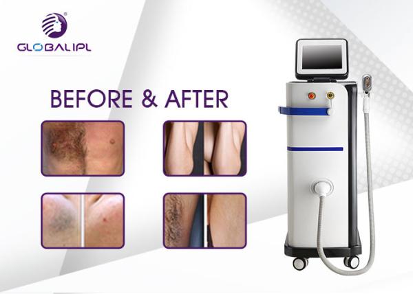 Beauty Salon Diode Hair Removal Laser Machine , IPL Hair Removal System AC 220V / 50Hz