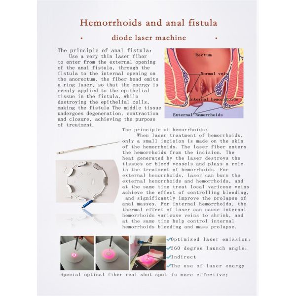 980+1470nm Laser Devices Mini Invasive Endovenous Laser Varicose Vein Surgery