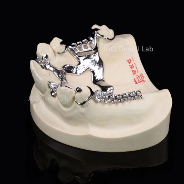 3D Laser Printing Removable Dentures Customized with Co-Cr Alloy Framework