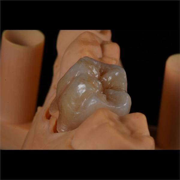 Personalized Strong Ceramic Zirconia Dental Crown Full Mouth Full Contour
