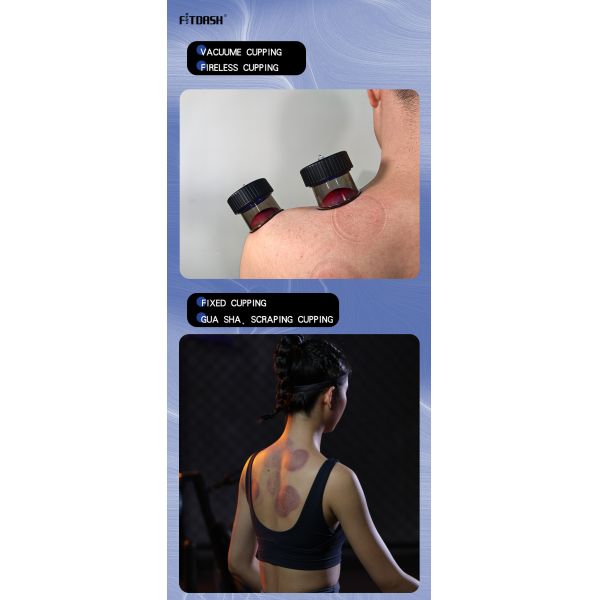 Massage Equipment Intelligent Vacuum Cupping Massager Set with Type-C Power Mode