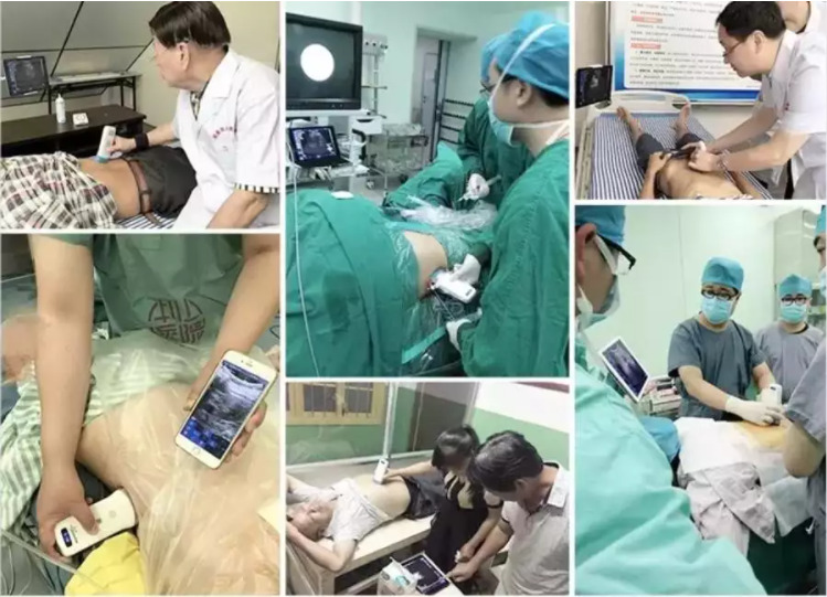 GYN Ultrasound Instruments Wireless Portable Clinical Probe Analytical Instruments Mobile Ultrasound Machine