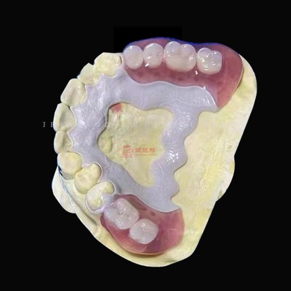 3D Printing Peek Frame Removable Dentures Acrylic Teeth China Dental Lab