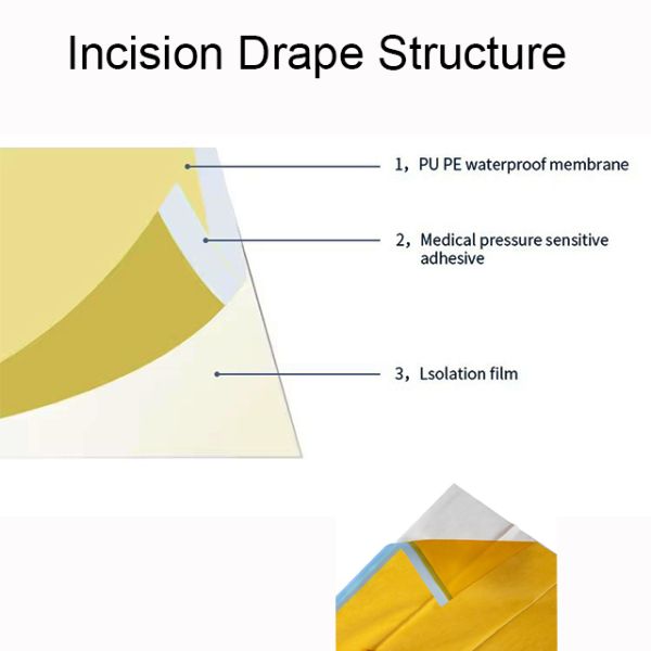 Ioban PU Surgical Incise Drape Antimicrobial Self Adhesive Wound Dressings