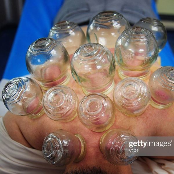 12 Cups Chinese Traditional Vacuum Hijama Massage Therapy Ventosa Cups Sterilizer Set