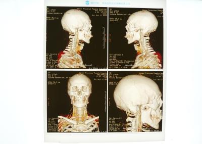 imagem latente médica Risco-resistente de X Ray para a impressora a laser de Konida