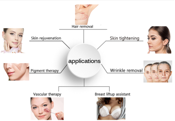 OPT 5 In 1 Hair Removal Powerful Laser IPL Machines / IPL OPT SHR For Hair And Skin Rejuvenation