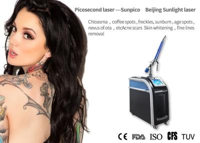 Age Spot Picosecond Laser Tattoo Removal Machine Long Working 1mm - 10mm Diameter